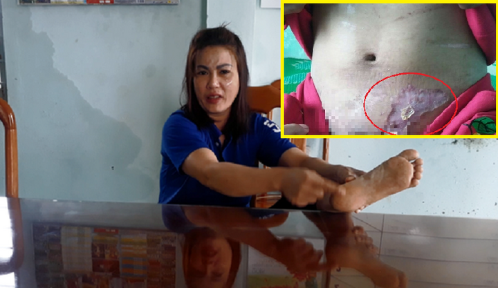 Lạnh sống lưng nghe nữ quái kể việc tra tấn dã man người làm thuê