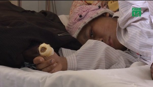 Clip: Giám định thương tật cho cô gái làm thuê bị chủ tra tấn dã man