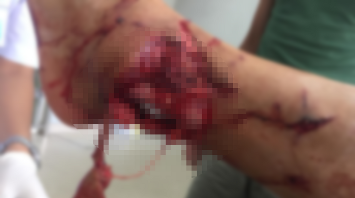 Nạn nhân ám ảnh bị chó cắn: Những con 'quái vật' vỏ bọc thân thiện nhà nuôi