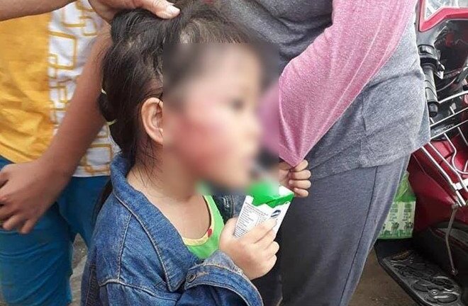 Bé gái bị bảo mẫu tát ở TP.HCM: Phát hiện cục máu bầm trong tai