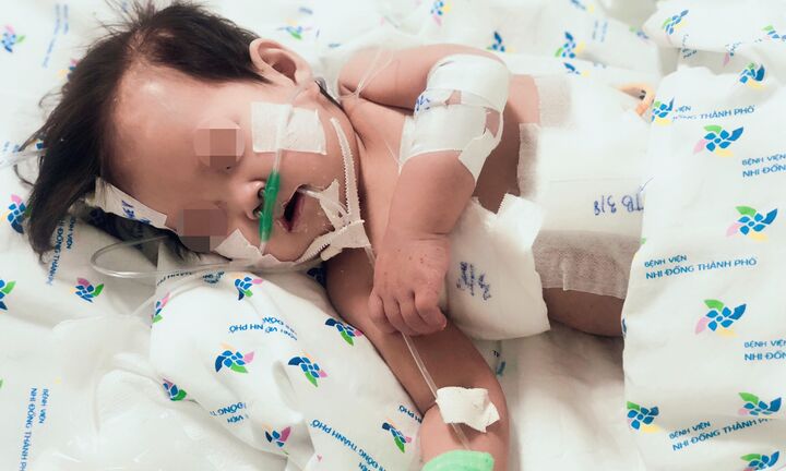 Sốt cao nhiều ngày, bé gái nhiễm 2 loại siêu vi khuẩn kháng tất cả các loại kháng sinh