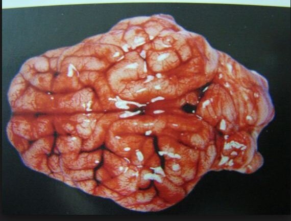 Quấy khóc không chịu ngủ, bé 2 tháng tuổi bị cha làm xuất huyết não