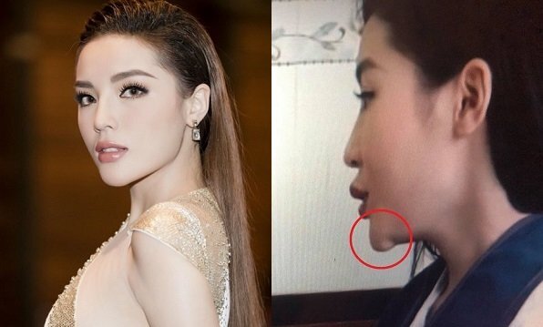 Phủ nhận ‘dao kéo’ gương mặt nhưng Kỳ Duyên lại để lộ chiếc cằm dị dạng ở góc nghiêng