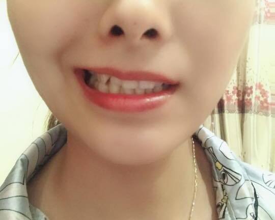 Cô gái xinh đẹp bị méo mồm vì nằm điều hòa quá nhiều