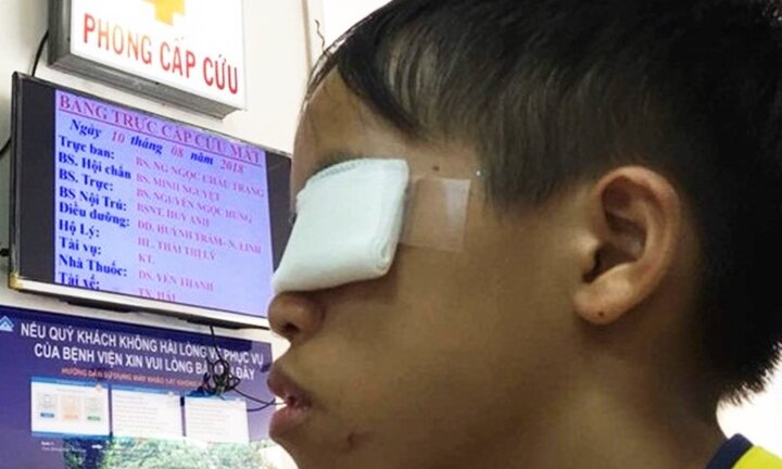 Nổ pháo tự chế bằng que diêm, bé trai bị hỏng mắt trái
