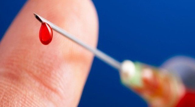 Tiếp xúc kim tiêm dính máu nhiễm HIV, phải xử trí thế nào?
