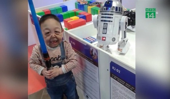 Cậu bé 6 tuổi da nhăn nheo, chảy xệ như ông già 60