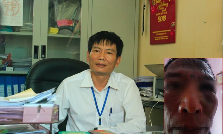 Sự thật dân tố bị công an xã bắt vô cớ, đánh đập dã man