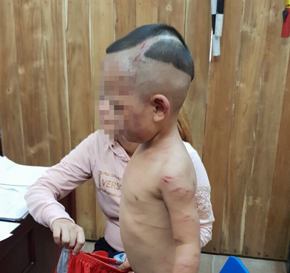 Sớm xét xử gã cha dượng hành hạ dã man bé trai 3 tuổi ở Phú Quốc