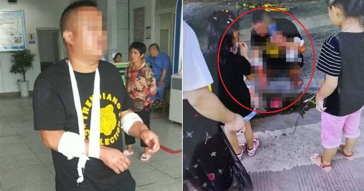Người đàn ông tự chém vào tay mình để không phải mua xe cho bạn gái