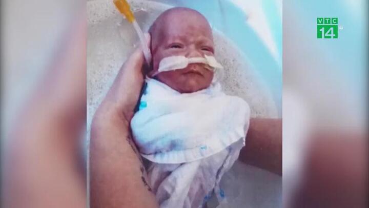 Chào đời chỉ nặng bằng lon nước ngọt, bé trai sống sót kỳ diệu