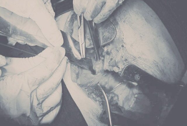 Nam thanh niên bị đâm thấu tim, sốc mất máu nặng được cứu