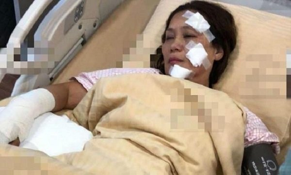 Cháy phim trường, nữ diễn viên 'Anh hùng xạ điêu' bỏng nặng