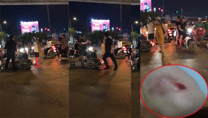 Nam thanh niên cao lớn đánh phụ nữ mang bầu sau va chạm giao thông: Công an vào cuộc điều tra