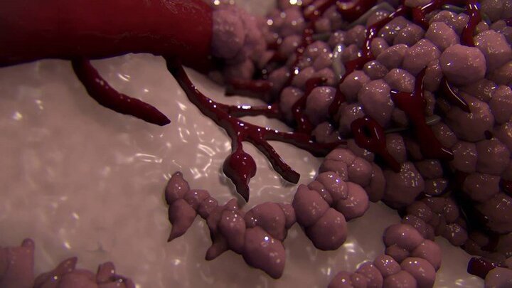 2018, Việt Nam đang ở đâu trên bản đồ ung thư thế giới?