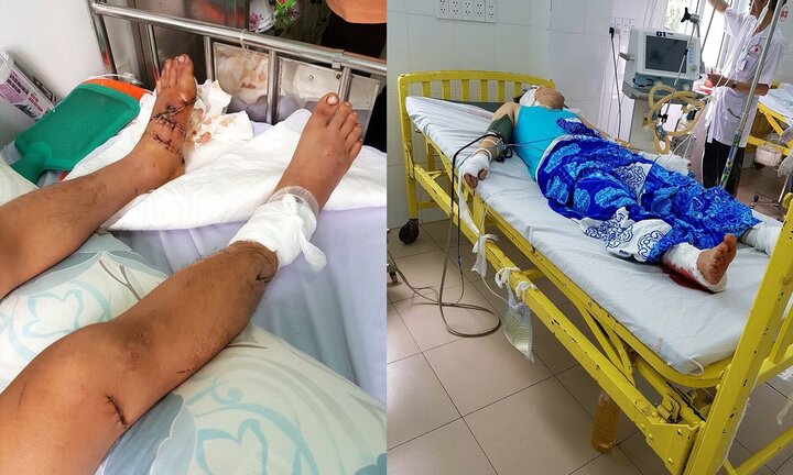 Nam thanh niên bị nhóm côn đồ lái xe tông trực diện, đâm chém giữa phố