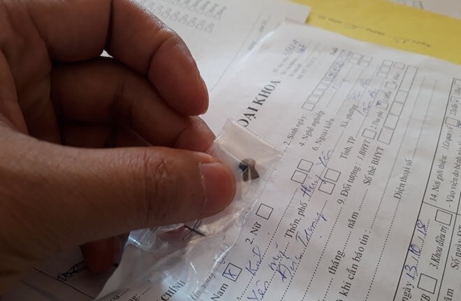 Đang làm vườn bị trúng đạn chì nhập viện