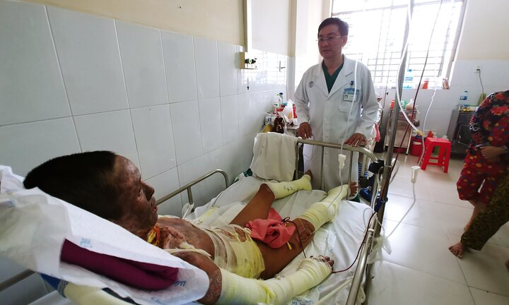 Sửa xe máy gây cháy, em vợ chết, anh nguy kịch