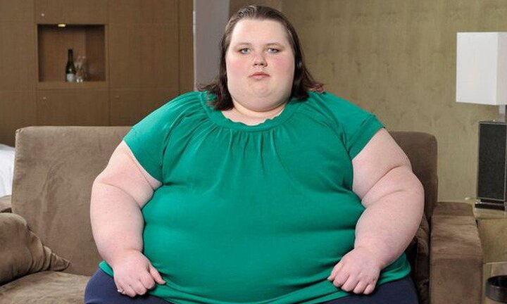 Béo phì khi mới 20 - 30 tuổi khiến bạn chết sớm hơn 10 năm