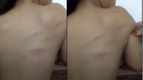 Nữ sinh bị giáo viên đánh ở Hà Tĩnh: Công an vào cuộc