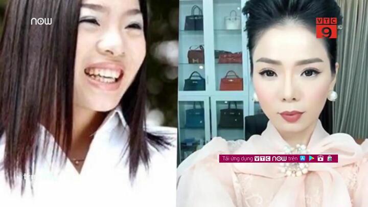 Video: Nhan sắc Lệ Quyên trước và sau khi phẫu thuật thẩm mỹ