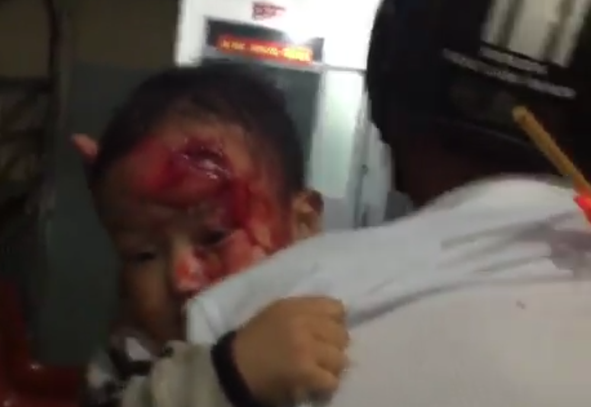 Người nhà bế con trai máu me đi tìm bác sĩ ở Đắk Lắk: Khiển trách kíp trực