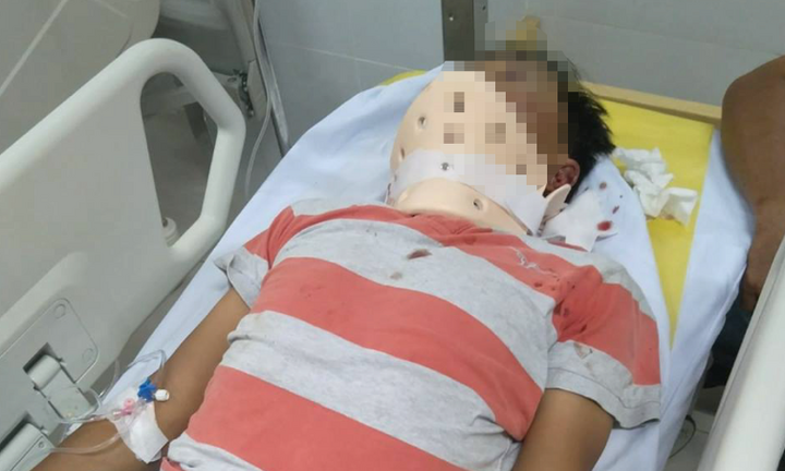 Truy tìm nhóm côn đồ đánh người đàn ông chấn thương sọ não tại Vĩnh Long