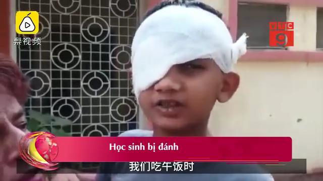 Ngồi sai vị trí, học sinh lớp 2 bị cô giáo đánh trọng thương