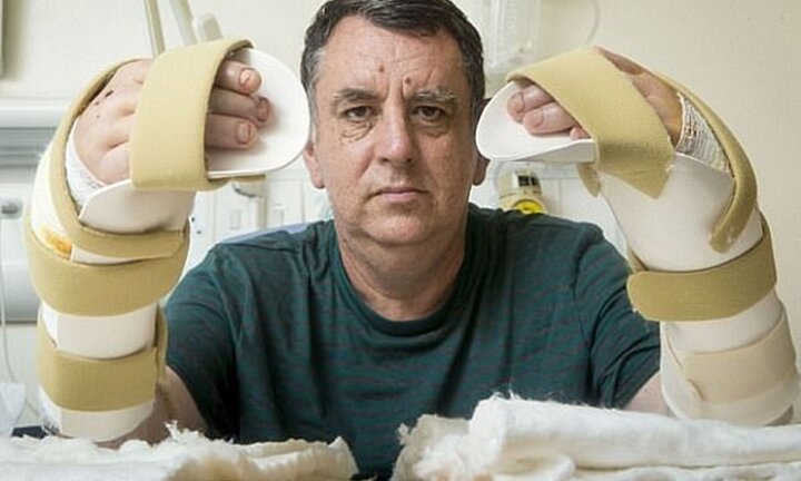 Clip: Kỳ diệu người đàn ông được ghép thành công đôi bàn tay mới