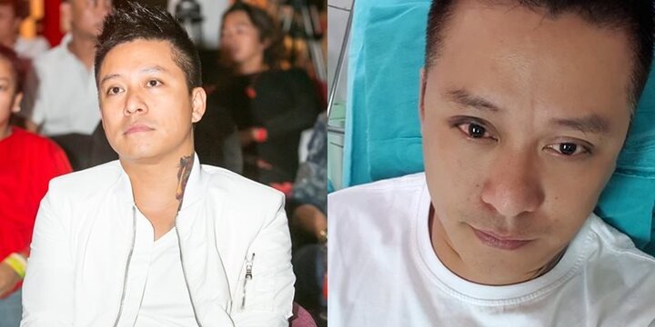 Tuấn Hưng tiết lộ thị lực chỉ còn 4/10, không thể nhìn rõ mọi thứ vì chấn thương nặng