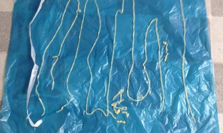 Phát hiện 108 người ở Bình Phước mắc bệnh sán dây lợn