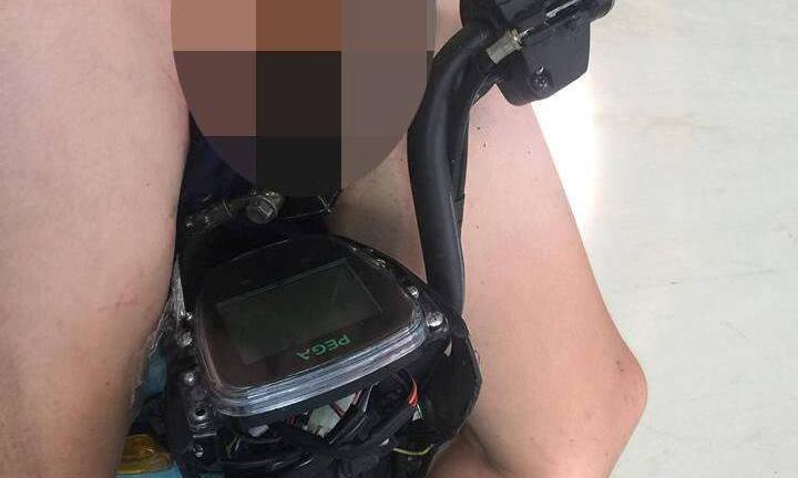 Bé trai bị tay lái xe đạp điện đâm qua vùng bẹn