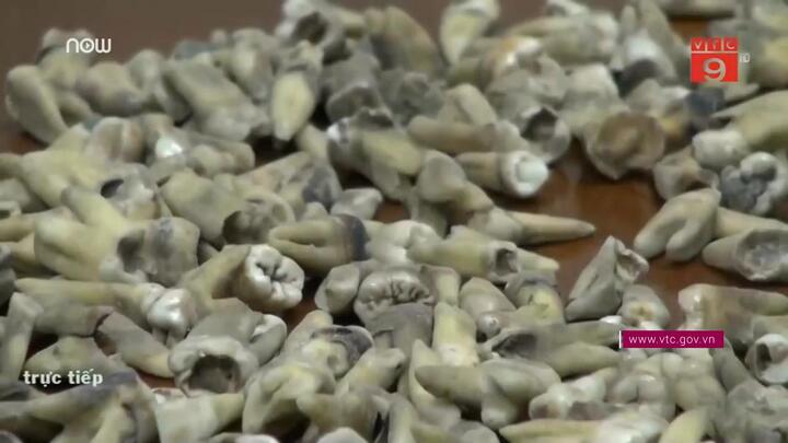 Bí ẩn bức tường chứa hơn 1.000 răng người