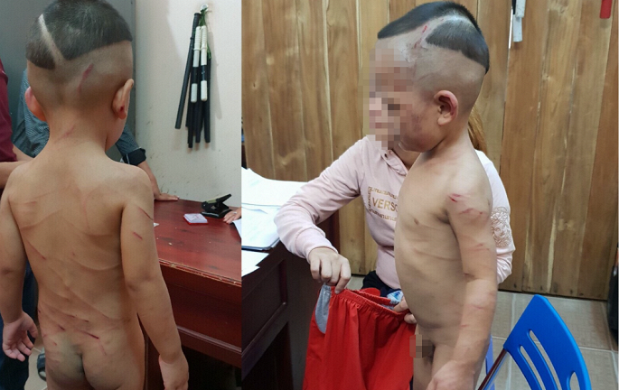 Gã cha dượng đánh đập dã man bé trai 3 tuổi ở Phú Quốc lãnh 3 năm 6 tháng tù