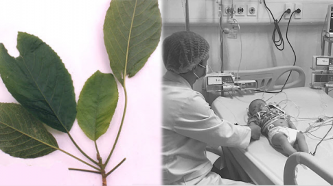 Dùng lá lộc mại chữa táo bón, bệnh nhi bị tan máu cấp thương tâm