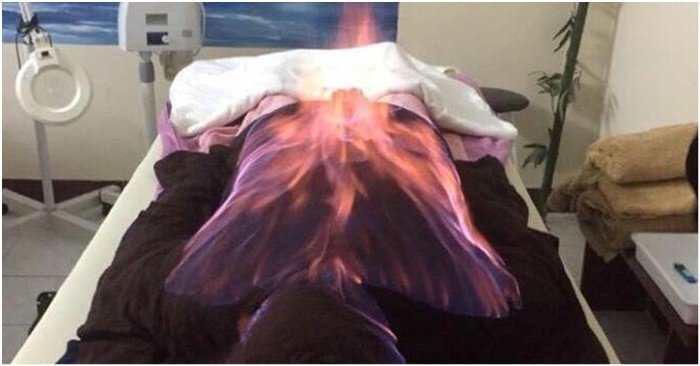 Bác sĩ lý giải việc 'trúng tà' khi sử dụng hỏa trị liệu làm đẹp