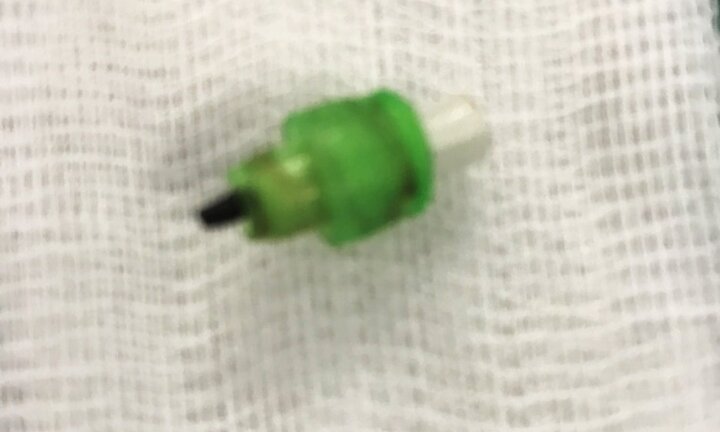 Thói quen ngậm bút chì khiến bé gái 7 tuổi suýt mất mạng