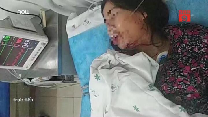 Thực hư chuyện cô dâu Việt bị chồng Trung Quốc bạo hành