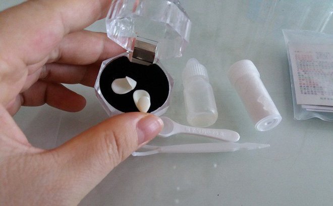 Mua răng giả gắn vào răng thật - trào lưu làm đẹp nguy hiểm của giới trẻ