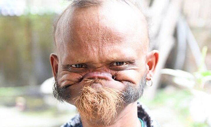 Ảnh: Điều ít biết về người đàn ông có thể dùng lưỡi liếm thẳng lên trán