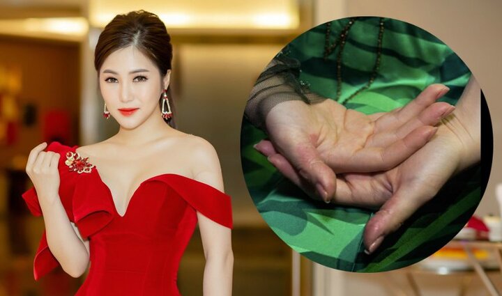 Hương Tràm: 'Thật kinh khủng khi mỗi sáng, mẹ dọn giường và thấy một đống da tay tôi vừa bóc'