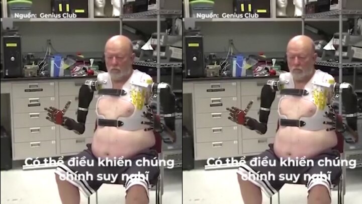 Cận cảnh đôi tay robot được điều khiển bằng chính suy nghĩ của người khuyết tật