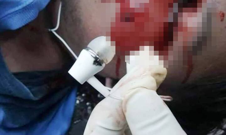 Dùng điện thoại khi đang sạc, thiếu niên 16 tuổi bị điện giật chết