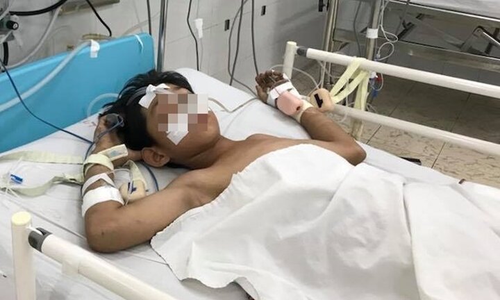 Bạn nghịch dại dùng ống hơi cao áp xịt vào vùng hậu môn, bé trai 13 tuổi thủng ruột nguy kịch