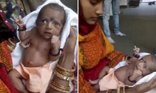 Bé gái Ấn Độ chào đời với ba tay được dân làng tôn thờ như vị thần
