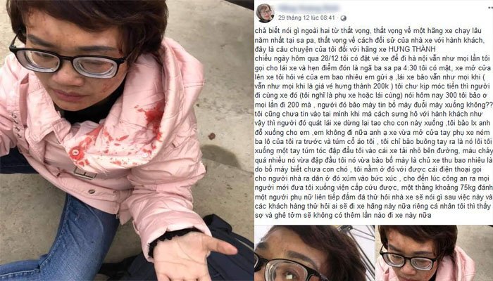 Phản ứng nhà xe tăng giá vé dịp nghỉ Tết, nữ hành khách bị đánh phải nhập viện