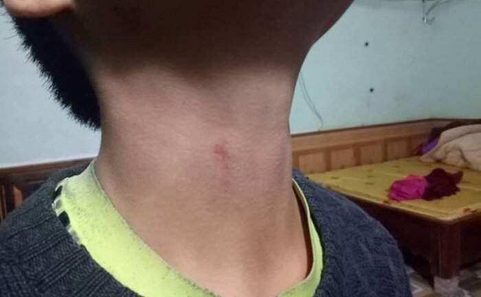 Phụ huynh tố hiệu trưởng bóp cổ học sinh, lãnh đạo Phòng GD&ĐT phủ nhận