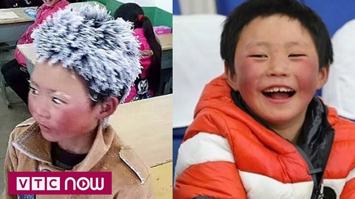 'Cậu bé băng tuyết' đổi đời sau 1 năm nổi tiếng