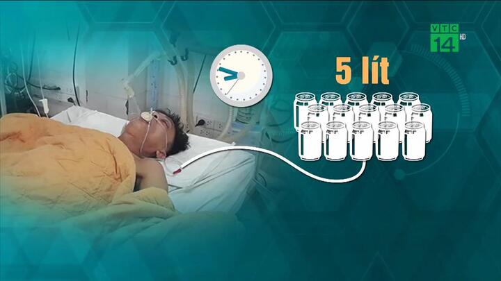 Tranh cãi phương pháp 'lấy độc trị độc': Truyền 5 lít bia để giải độc rượu