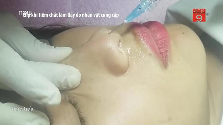 Làm đẹp đón Tết, coi chừng tai biến đột quỵ, mù vĩnh viễn